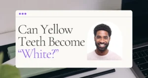 Yellow Teeth Blog Header